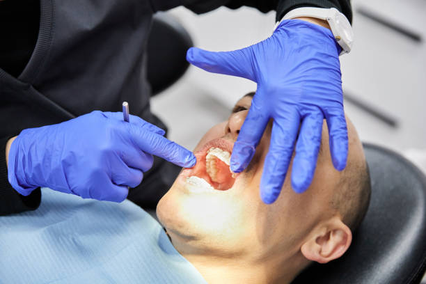 Best Dentist for Tooth Abscess  in Ocean Ridge, FL